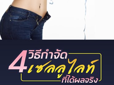 4 วิธีกำจัดเซลลูไลท์