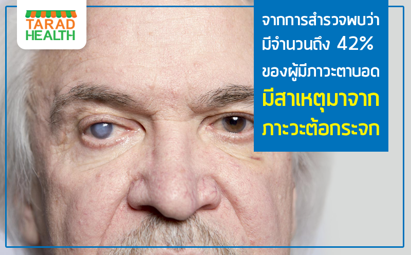 จากการสำรวจพบว่ามีจำนวนถึง 42% ของผู้มีภาวะตาบอด มีสาเหตุมาจากภาะวะต้อกระจก