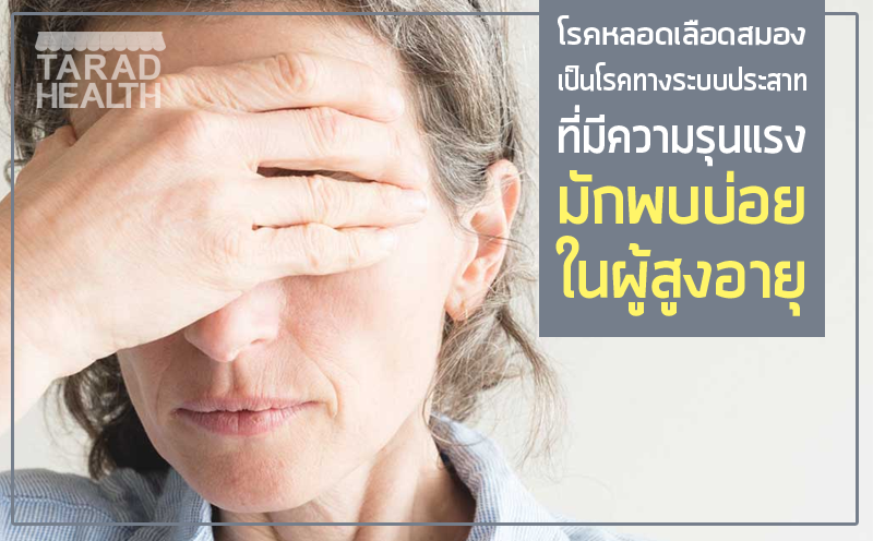 โรคหลอดเลือดสมอง เป็นโรคทางระบบประสาทที่มีความรุนแรงมักพบบ่อยในผู้สูงอายุ